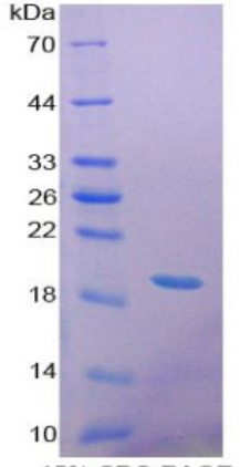 SDS PAGE (GBA-7841H).jpg